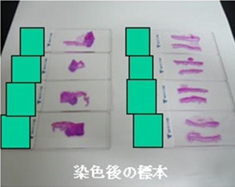 病理組織診断④染色